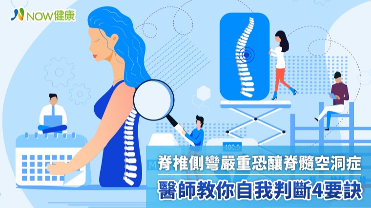 脊椎側彎嚴重恐釀脊髓空洞症 醫師教你自我判斷4要訣 脊椎側彎嚴重恐釀脊髓空洞症 醫師教你自我判斷4要訣