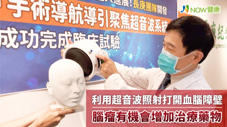 利用超音波照射打開血腦障壁 腦瘤有機會增加治療藥物 利用超音波照射打開血腦障壁 腦瘤有機會增加治療藥物