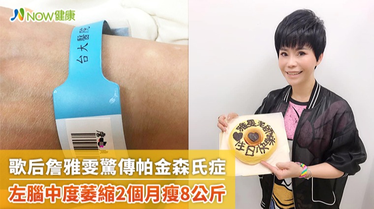 詹雅雯驚傳罹患帕金森氏症 10大症狀有3項應提高警覺 詹雅雯驚傳罹患帕金森氏症 10大症狀有3項應提高警覺