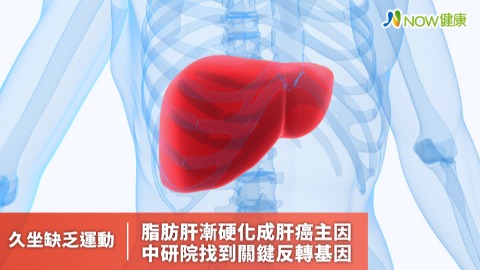 久坐缺乏運動脂肪肝漸硬化成肝癌主因 中研院找到關鍵反轉基因