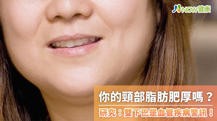 你的頸部脂肪肥厚嗎? 研究:雙下巴是血管疾病警訊! 你的頸部脂肪肥厚嗎? 研究:雙下巴是血管疾病警訊!
