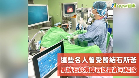 這些名人曾受腎結石所苦 腎結石危機摩西鈥雷射可解除