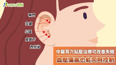 中醫耳穴貼壓治療可改善失眠 血壓偏高也能同時控制