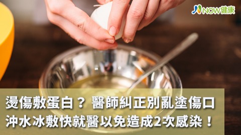 燙傷敷蛋白？ 醫師糾正別亂塗傷口 沖水冰敷快就醫以免造成2次感染！