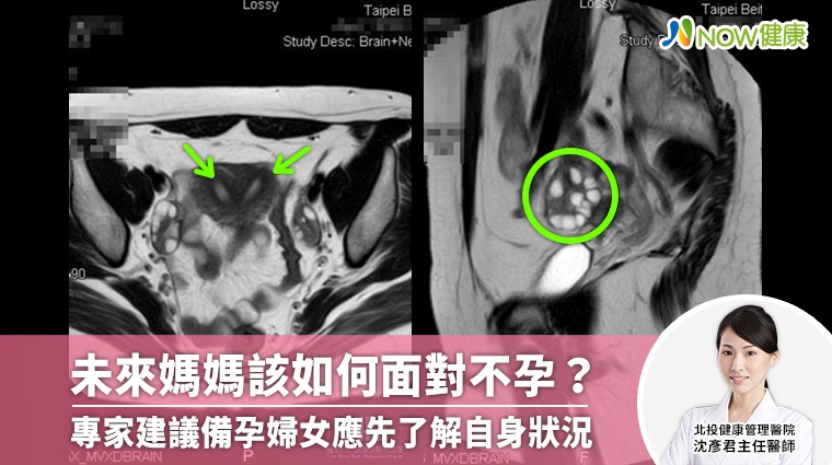 未來媽媽該如何面對不孕?專家建議備孕婦女應先了解自身狀況 未來媽媽該如何面對不孕?專家建議備孕婦女應先了解自身狀況