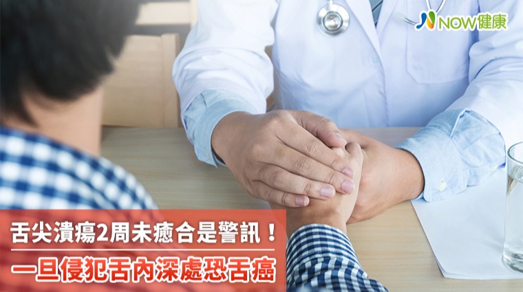 舌尖潰瘍2周未癒合是警訊 一旦侵犯舌內深處恐舌癌 舌尖潰瘍2周未癒合是警訊 一旦侵犯舌內深處恐舌癌