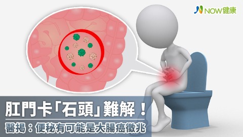 肛門卡「石頭」難解！ 醫揭：便秘有可能是大腸癌徵兆