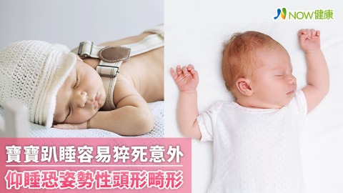 寶寶趴睡容易猝死意外 仰睡恐姿勢性頭形畸形