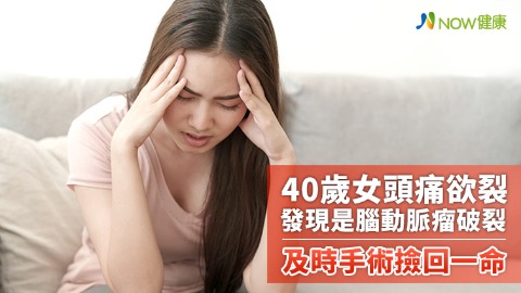 40歲女頭痛欲裂發現是腦動脈瘤破裂 及時手術撿回一命