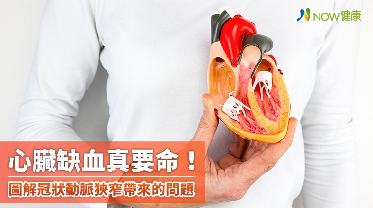心臟缺血真要命! 圖解冠狀動脈狹窄帶來的問題 心臟缺血真要命! 圖解冠狀動脈狹窄帶來的問題