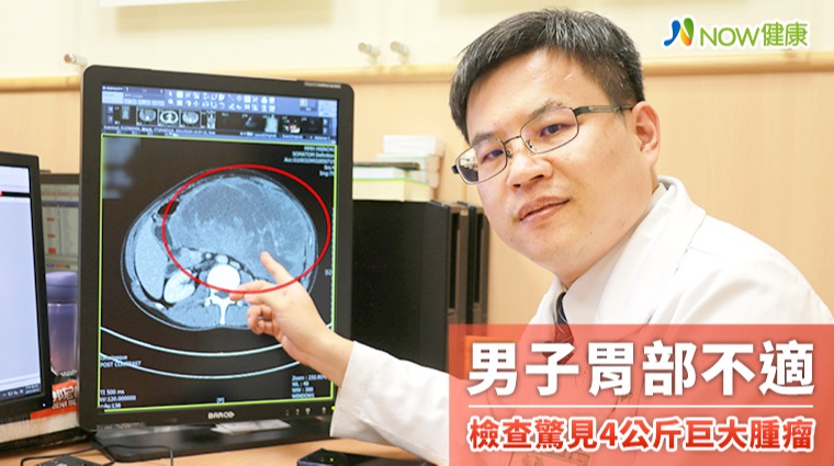 男子胃部不適 檢查驚見4公斤巨大腫瘤