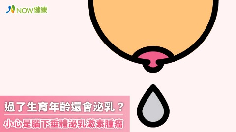 孩子已成年57歲婦突然泌乳一年 醫師提醒小心腦下垂體異常壓迫視神經導致失明