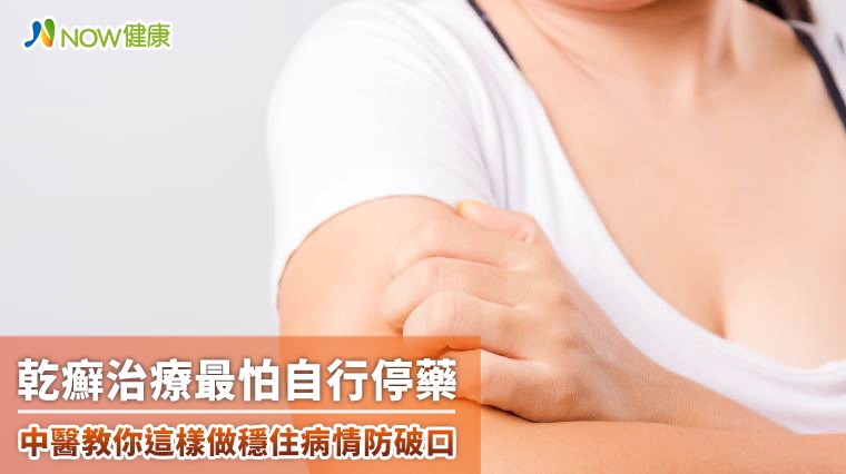 乾癬最怕自行停藥 反而容易加重病情 乾癬最怕自行停藥 反而容易加重病情