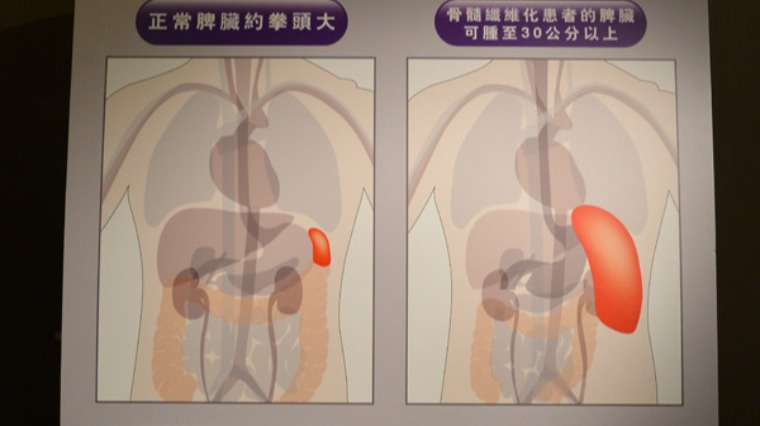 示意圖 示意圖