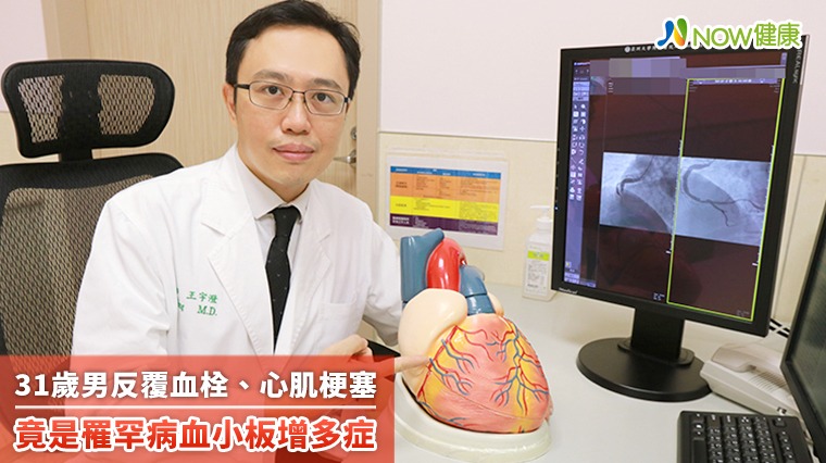 31歲男反覆血栓、心肌梗塞 竟是罹罕病血小板增多症 31歲男反覆血栓、心肌梗塞 竟是罹罕病血小板增多症