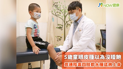 5歲童眼皮腫以為沒睡飽 竟連陰囊四肢都水腫這病上身