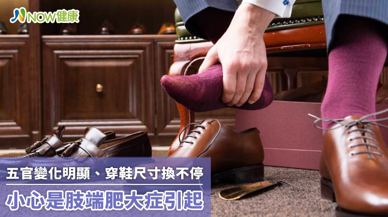 五官變化明顯、穿鞋尺寸換不停 小心是肢端肥大症引起 五官變化明顯、穿鞋尺寸換不停 小心是肢端肥大症引起