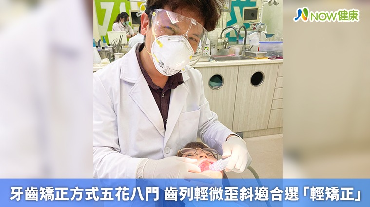 牙齒矯正方式五花八門 齒列輕微歪斜適合選「輕矯正」 牙齒矯正方式五花八門 齒列輕微歪斜適合選「輕矯正」