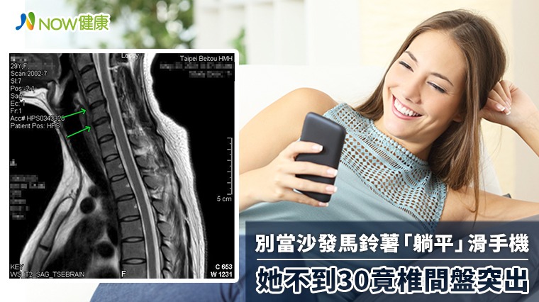 別當沙發馬鈴薯「躺平」滑手機 她不到30竟椎間盤突出 別當沙發馬鈴薯「躺平」滑手機 她不到30竟椎間盤突出