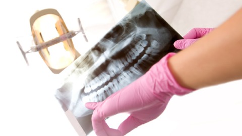 3D列印植牙夯 牙醫師：經驗判斷才是關鍵