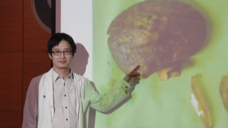 腸胃結石 腸胃結石