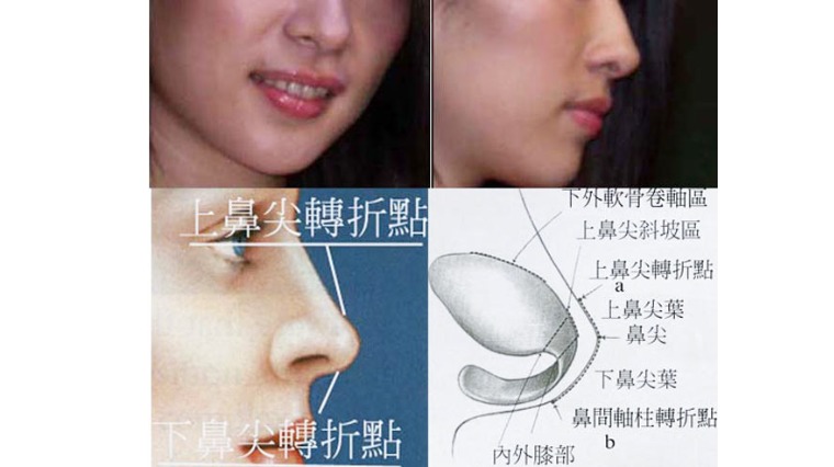 示意圖 示意圖