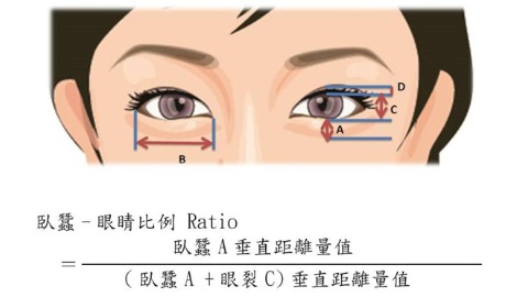 電眼臥蠶黃金比