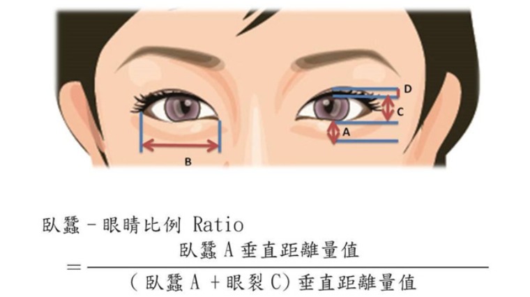 電眼臥蠶黃金比