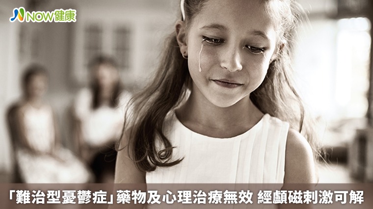 「難治型憂鬱症」藥物及心理治療無效 經顱磁刺激可解