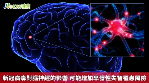 新冠病毒對腦神經的影響 可能增加早發性失智罹患風險