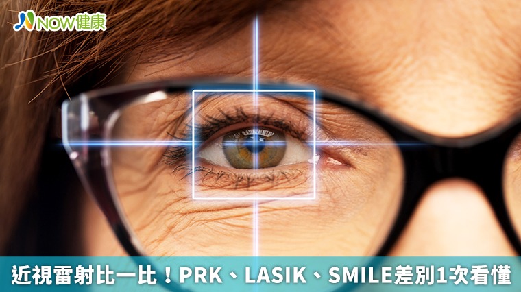 近視雷射比一比! PRK、LASIK、SMILE差別1次看懂 近視雷射比一比! PRK、LASIK、SMILE差別1次看懂