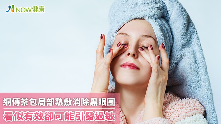 網傳茶包局部熱敷消除黑眼圈 看似有效卻可能引發過敏 網傳茶包局部熱敷消除黑眼圈 看似有效卻可能引發過敏