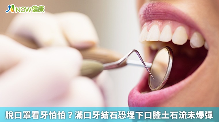 脫口罩看牙怕怕？ 滿口牙結石恐埋下口腔土石流未爆彈