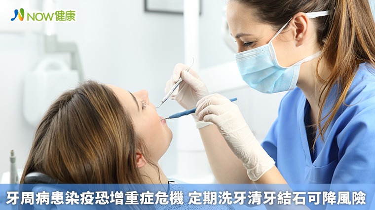 牙周病患染疫恐增重症危機 定期洗牙清牙結石可降風險 牙周病患染疫恐增重症危機 定期洗牙清牙結石可降風險