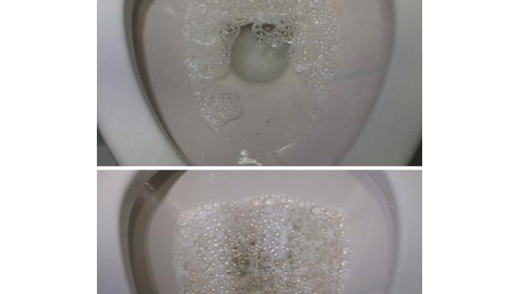 尿液 尿液