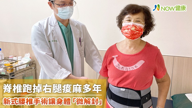 脊椎跑掉右腿痠麻多年 新式腰椎手術讓身體「微解封」 脊椎跑掉右腿痠麻多年 新式腰椎手術讓身體「微解封」