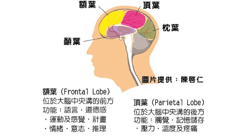 腦震盪後症候群 高中女生爛英文突然變好