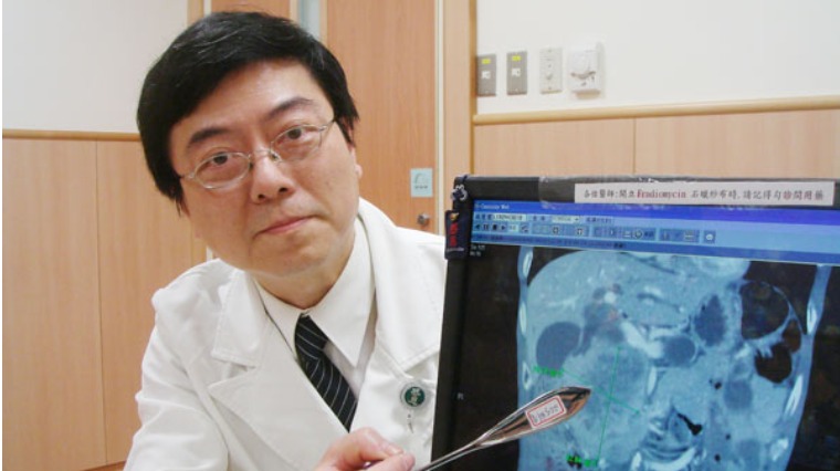 罕見胰臟癌作祟 雙腳潰爛30年