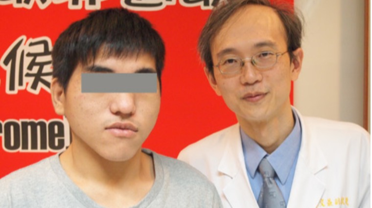 先天性免疫缺損 少年過敏反覆發作 先天性免疫缺損 少年過敏反覆發作