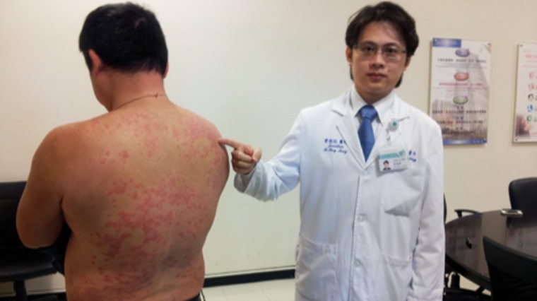 乾癬患者應及早控制 以防心血管疾病發生 乾癬患者應及早控制 以防心血管疾病發生