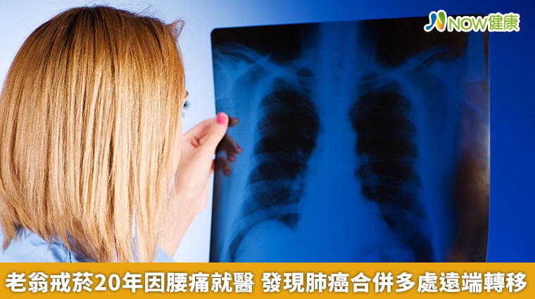 老翁戒菸20年因腰痛就醫 發現肺癌合併多處遠端轉移 老翁戒菸20年因腰痛就醫 發現肺癌合併多處遠端轉移