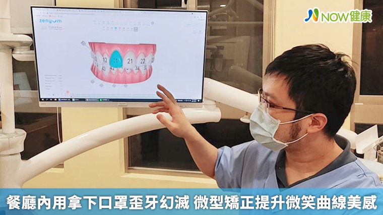 餐廳內用拿下口罩歪牙幻滅 微型矯正提升微笑曲線美感