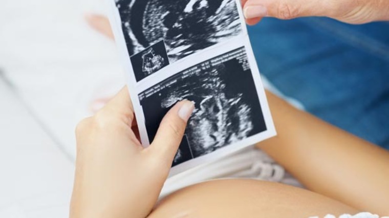孕婦就醫一律不鎖卡 健保新政策 揪感心 孕婦就醫一律不鎖卡 健保新政策 揪感心