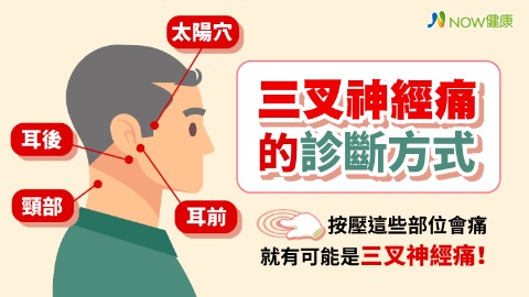 拔了牙還是痛？ 三叉神經痛誤診率高中醫教你簡單判斷