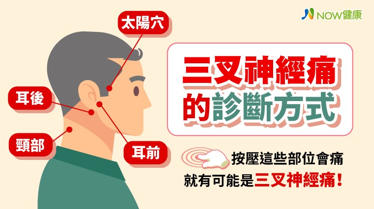 拔了牙還是痛？ 三叉神經痛誤診率高中醫教你簡單判斷