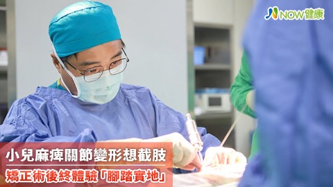 小兒麻痺關節變形想截肢 矯正術後終體驗「腳踏實地」