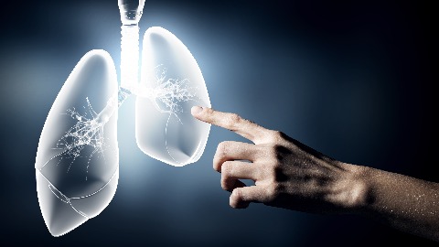 早做肺功能檢查 掌握慢阻肺黃金治療期