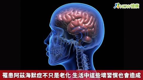 罹患阿茲海默症不只是老化 生活中這些壞習慣也會造成