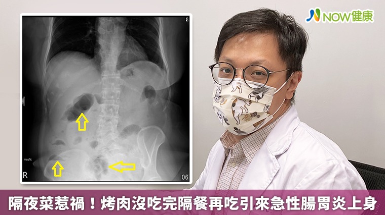 隔夜菜惹禍! 烤肉沒吃完隔餐再吃引來急性腸胃炎上身 隔夜菜惹禍! 烤肉沒吃完隔餐再吃引來急性腸胃炎上身
