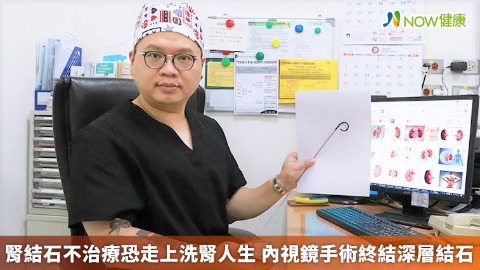 腎結石不治療恐走上洗腎人生 內視鏡手術終結深層結石